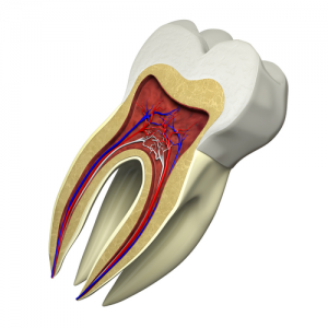 rootcanal